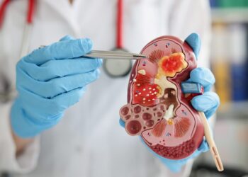 Ante incertidumbre sobre el sistema de salud, asociación de nefrología alerta sobre la situación de 3.5 millones de pacientes renales 