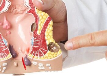 Implementan campaña de concientización frente al cáncer de recto y colon en la isla de San Andrés  