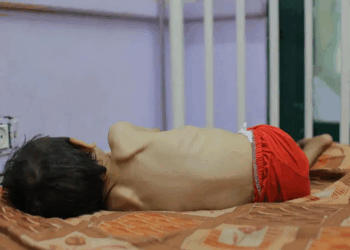 «Los niños dicen que desearían morir para poder ir al cielo y comer»: la hambruna se extiende en Gaza mientras Israel prepara el asalto a la mayor ciudad de la Franja